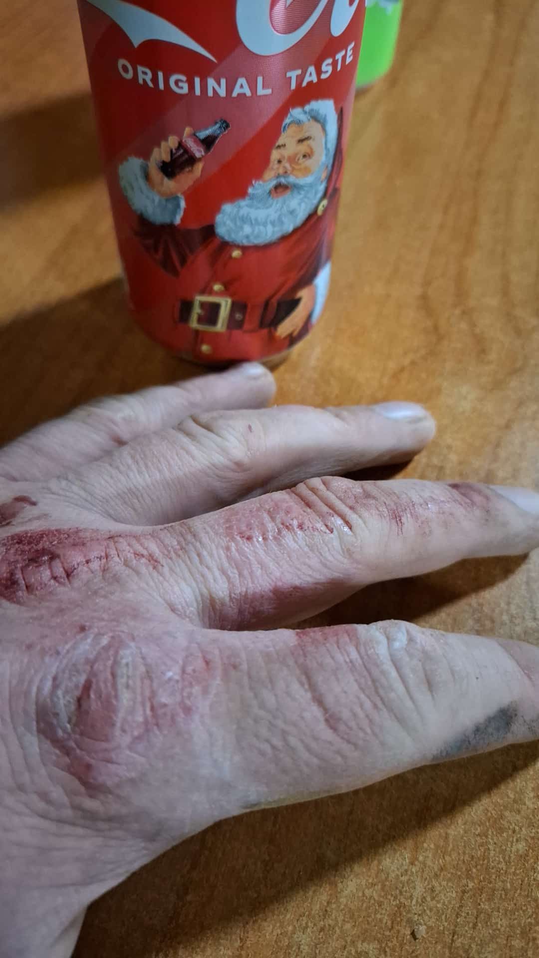 MWE: Stetig HARTE ARBEIT und blutige Hände!